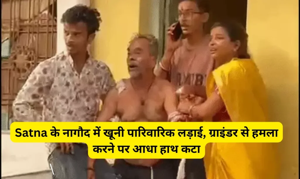 Bloody family feud in Nagod Satna half a hand cut off when attacked by a grinder